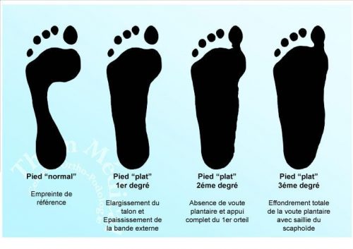 empreinte_pied_plat_large