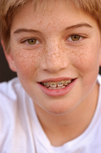 appareil-dentaire-enfant