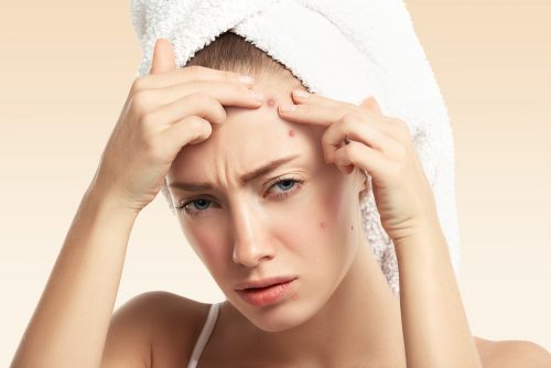acne-femme-visage