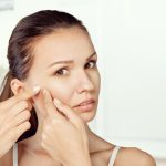 acne-visage